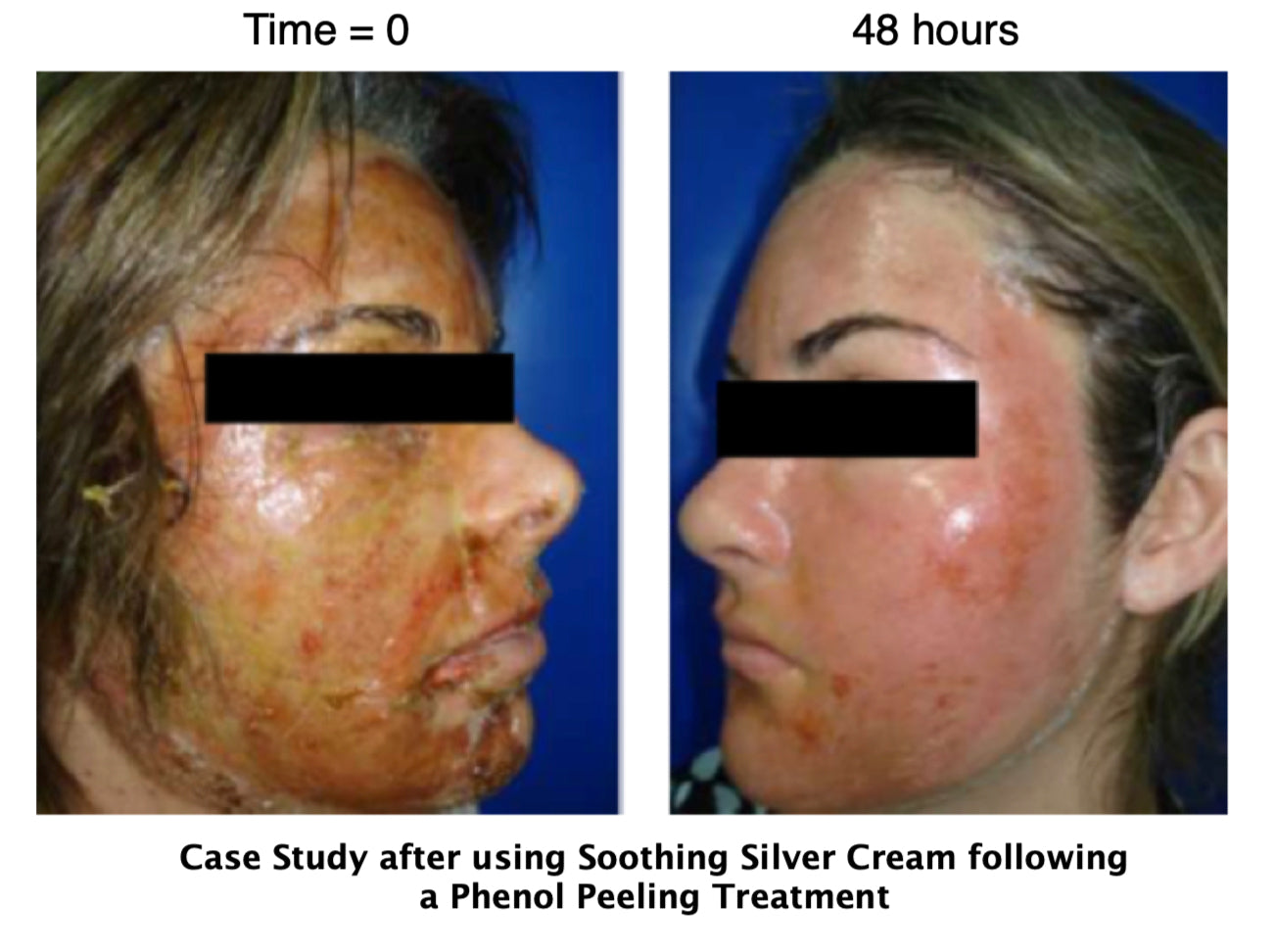 Soothing Silver Cream image 3