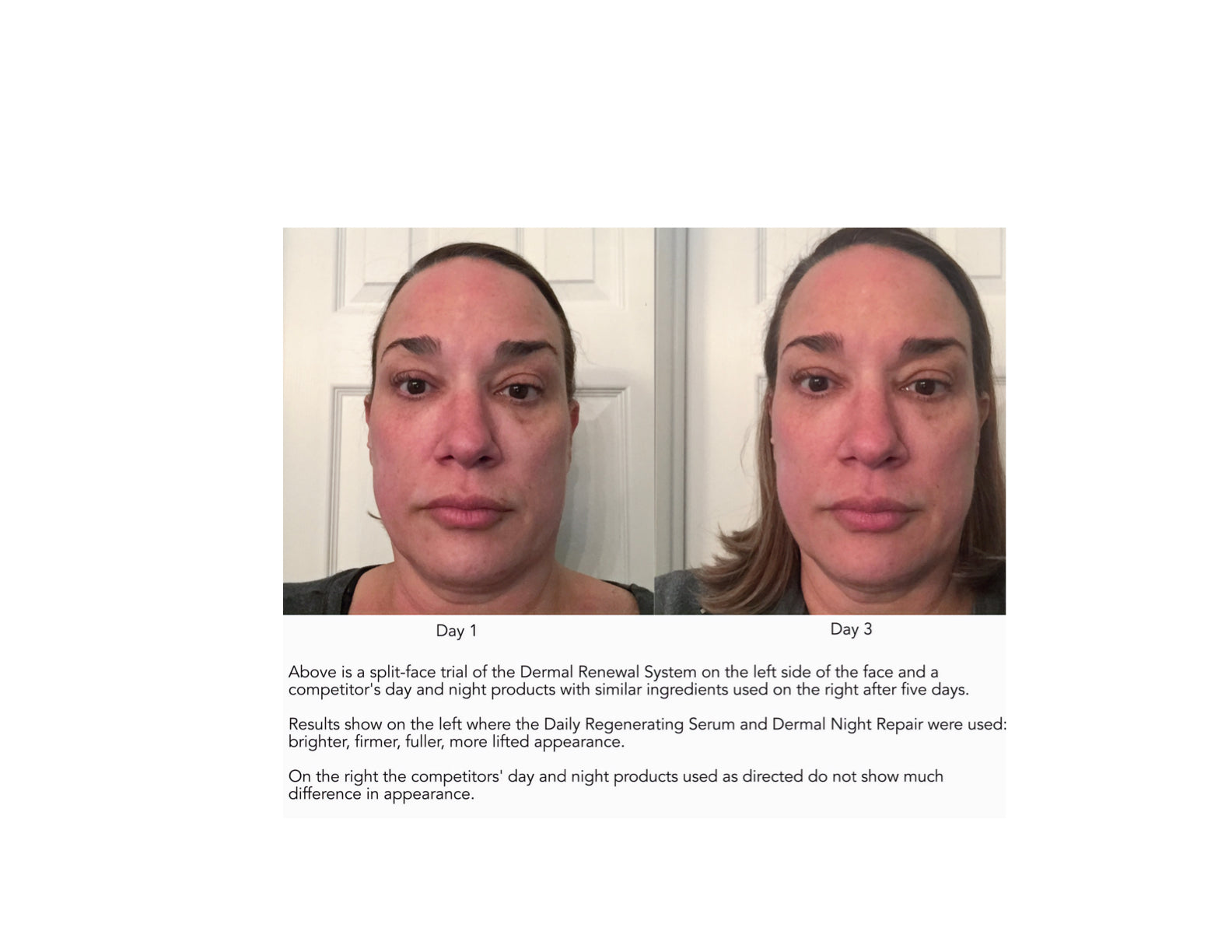 Dermal Renewal  Anti-Aging System image 2