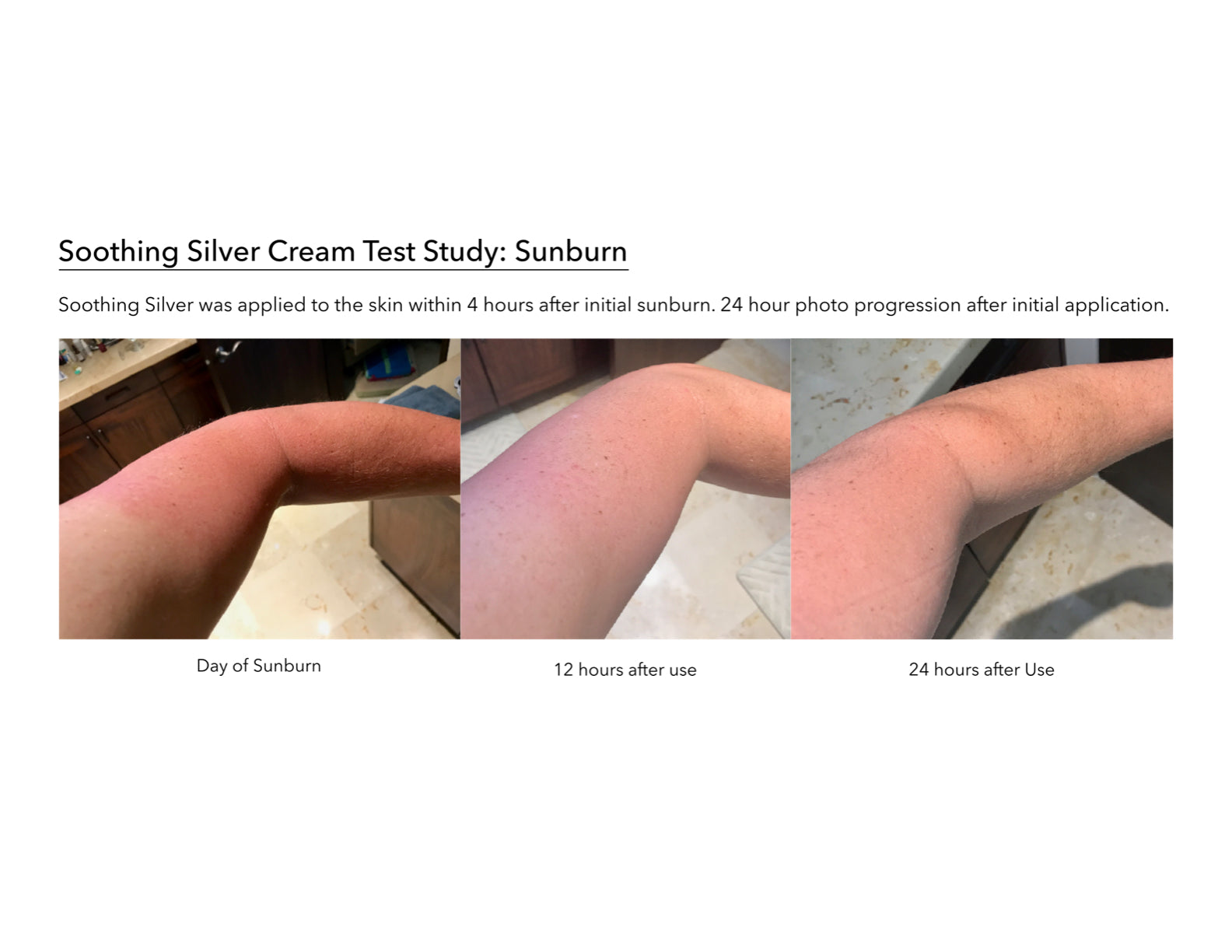 Emergency Sunburn Relief image 3
