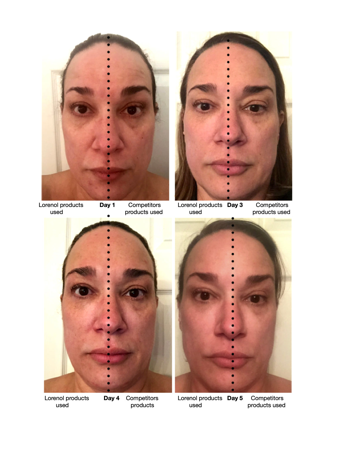 Dermal Renewal  Anti-Aging System image 3