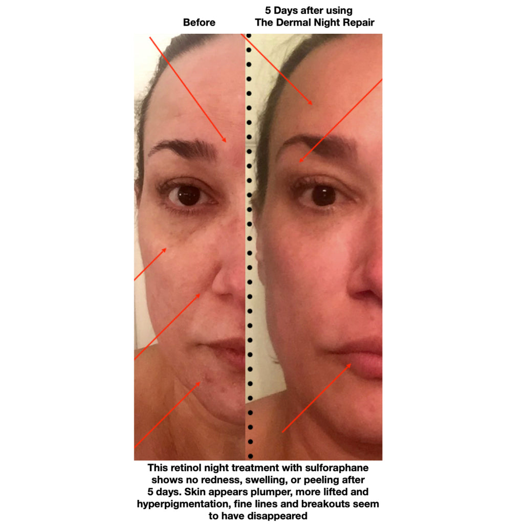 Dermal Night Repair w/ Retinol image 1