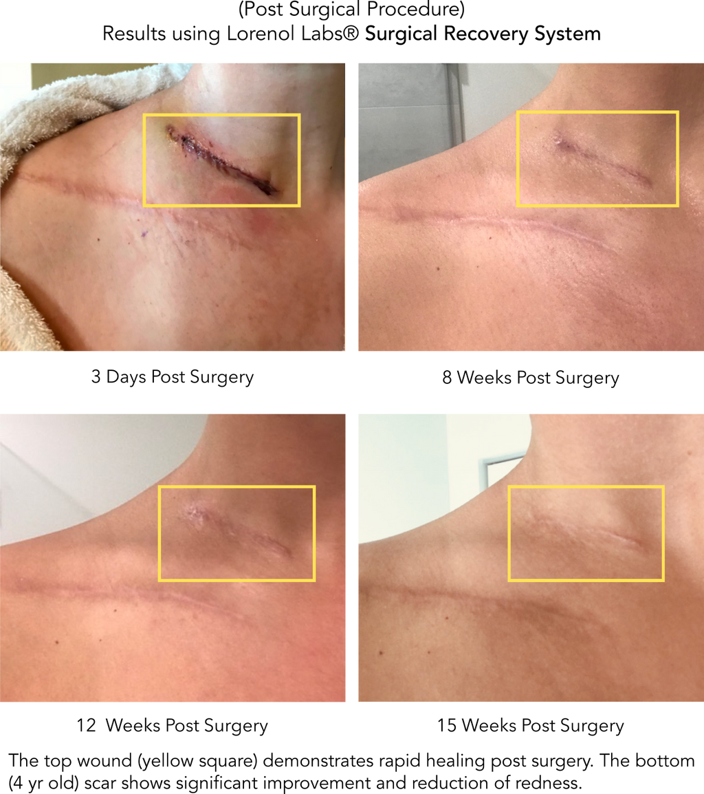 Surgical Recovery System image 2