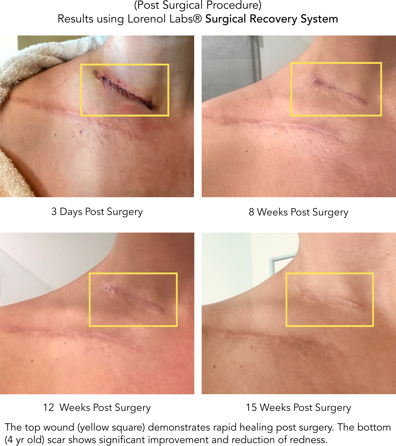 Surgical Recovery System image 2