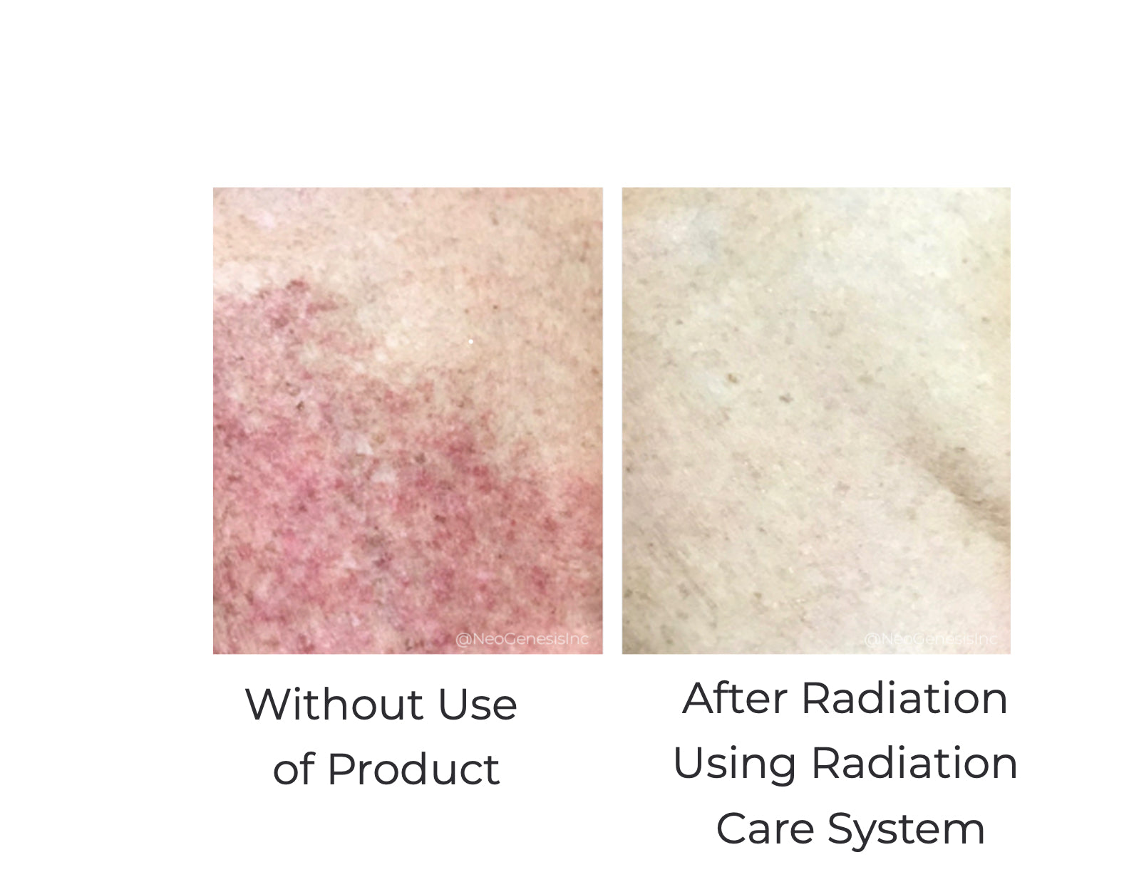 Radiation Care System image 3