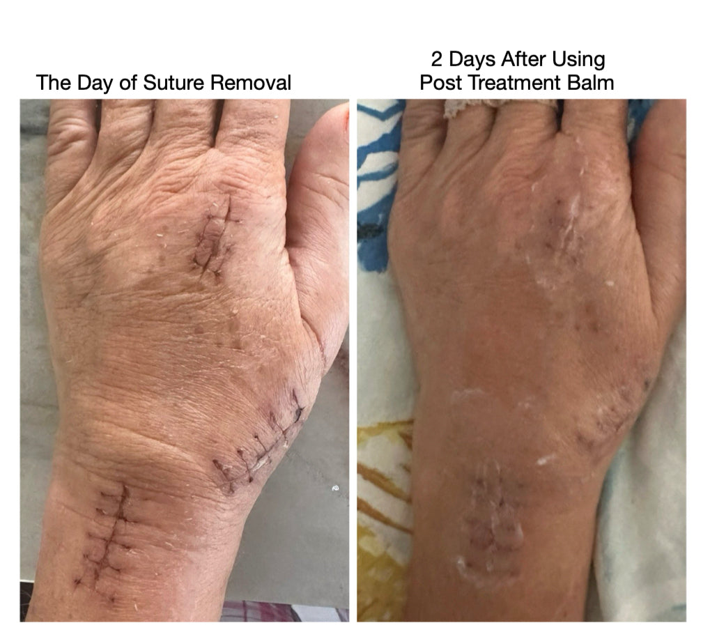 Surgical Recovery System image 4